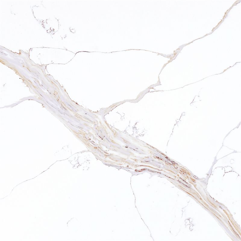 KVA9918 FOUNTAIN GOLD SAMPLE